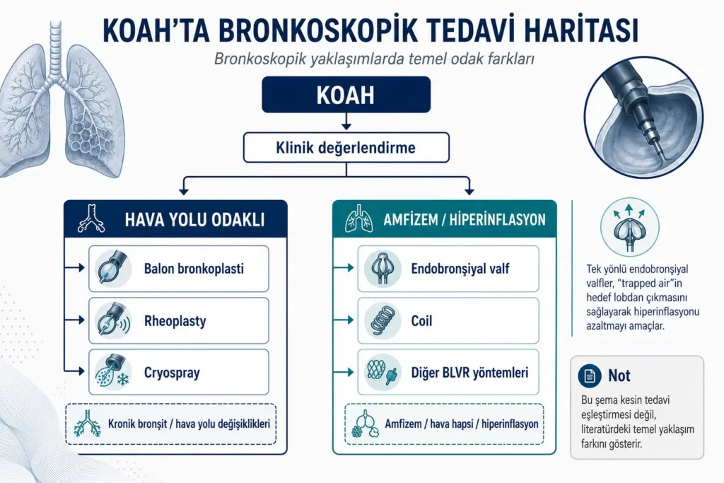 KOAH'ta hava yolu odaklı ve amfizem odaklı bronkoskopik tedavi seçeneklerini gösteren şema
