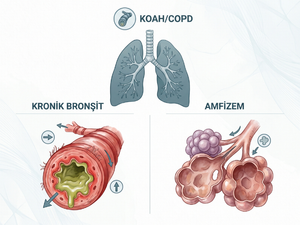 Balon bronkoplasti ve endobronşiyal valfin hava yolu ve akciğer hacmi üzerindeki farklı etkileri